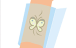 広範囲のタトゥー(刺青)除去の流れ 2